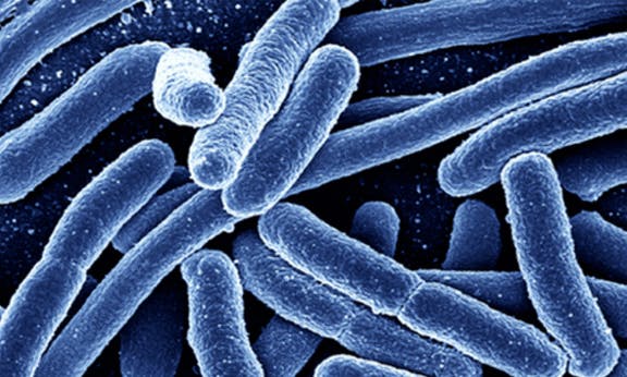 Superbugs to kill 10 million a year by 2050